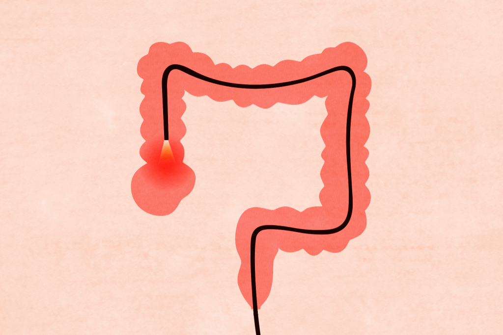 Here’s What to Expect Before, During, and After a Colonoscopy
