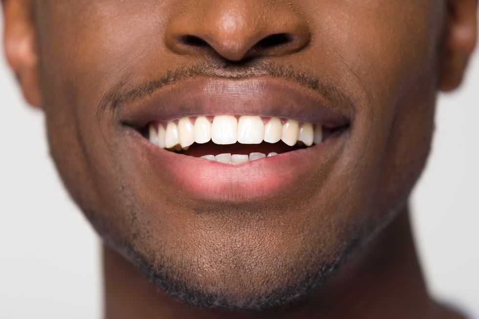 These Are the Best Dentist-Recommended Teeth-Whitening Kits
