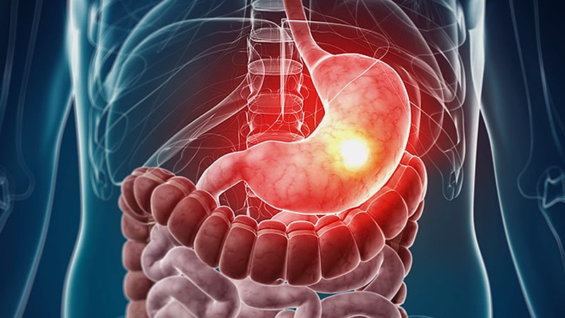 ESG’s Cardiometabolic Benefits Last 5 Years