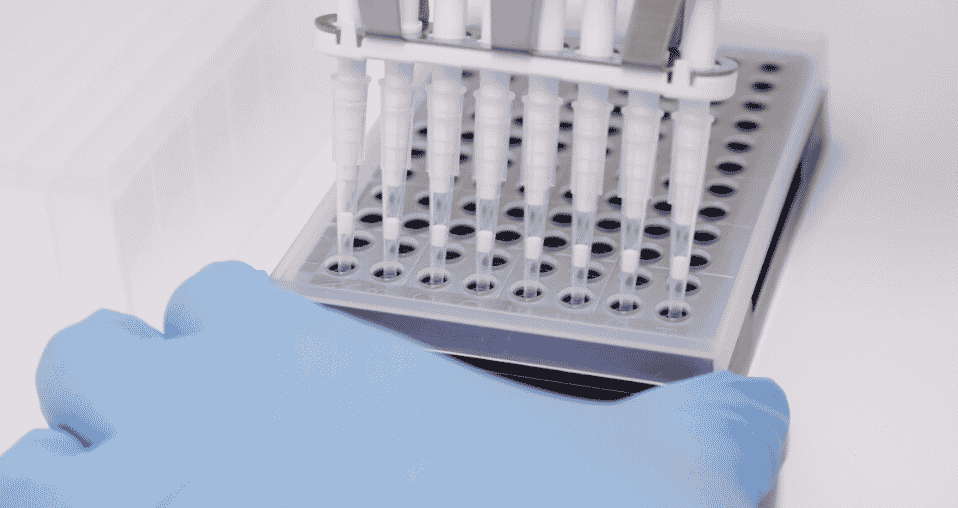 Likely Monkeypox Cases Reported in THESE Major U.S. Cities