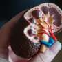 Analysis reveals sex differences in the recognition, monitoring and treatment of chronic kidney disease