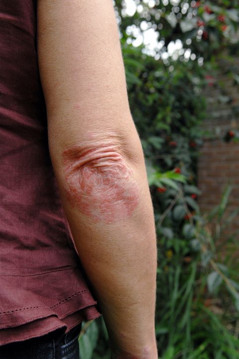 6 Habits That Could Be Making Your Skin Worse