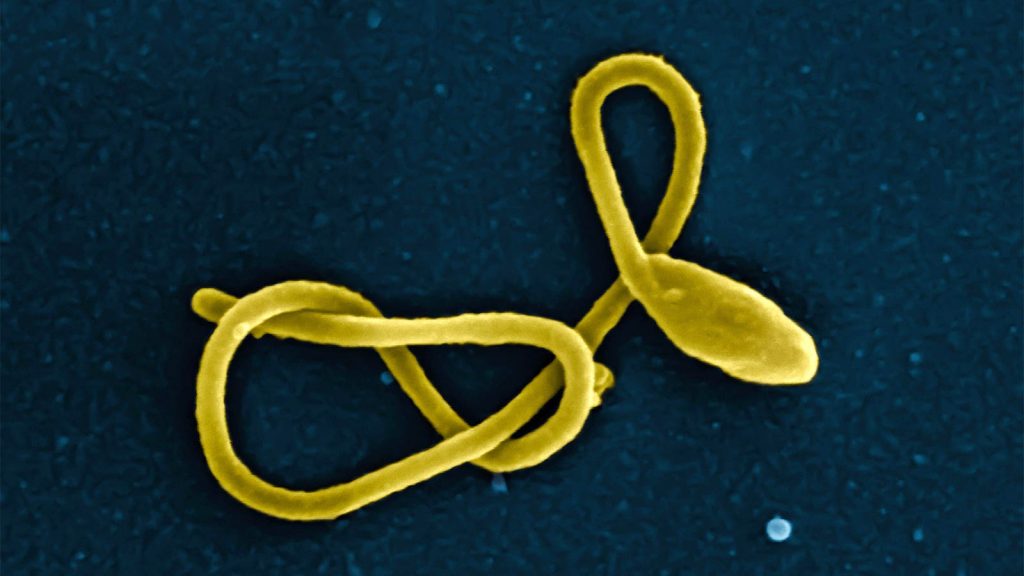 Ebola Will Spread if Resources Are Not Brought to Bear