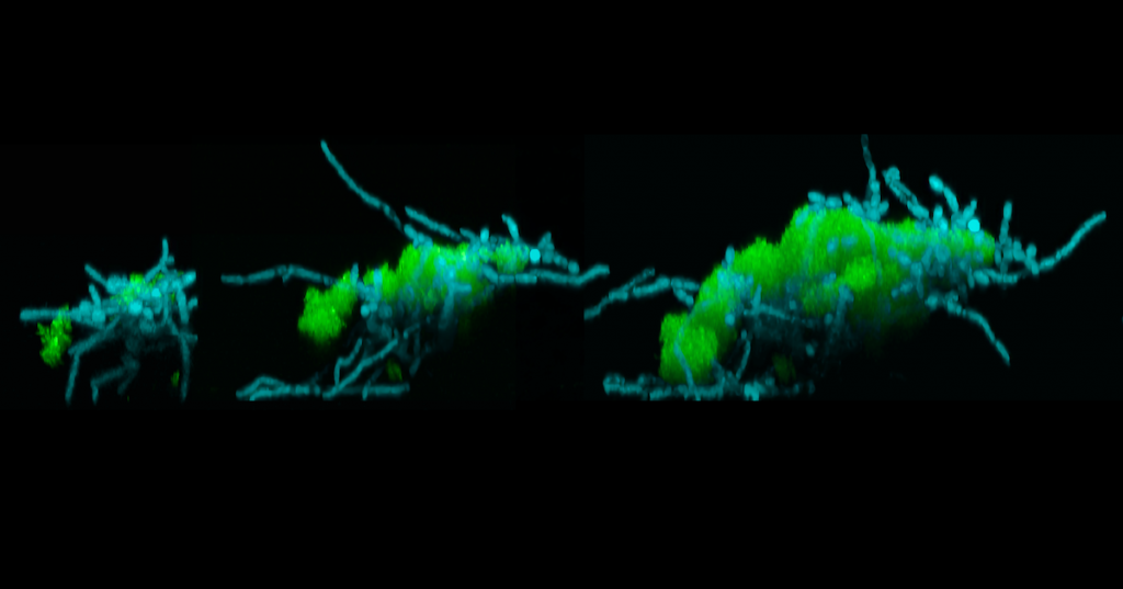 Microbes that cause cavities can form superorganisms able to ‘crawl’