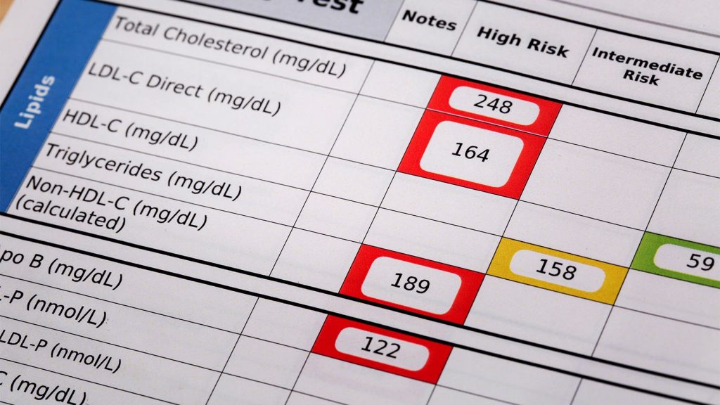 Importance of HDL Cholesterol Overstated for Black Adults