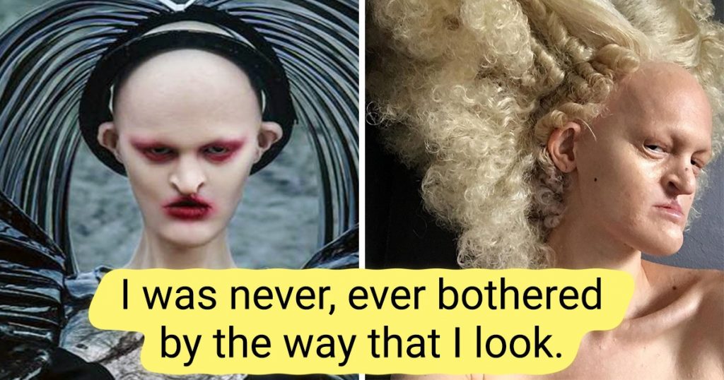 Meet Melanie Gaydos, a Model With Rare Genetic Conditions Who Broke All Fashion Stereotypes