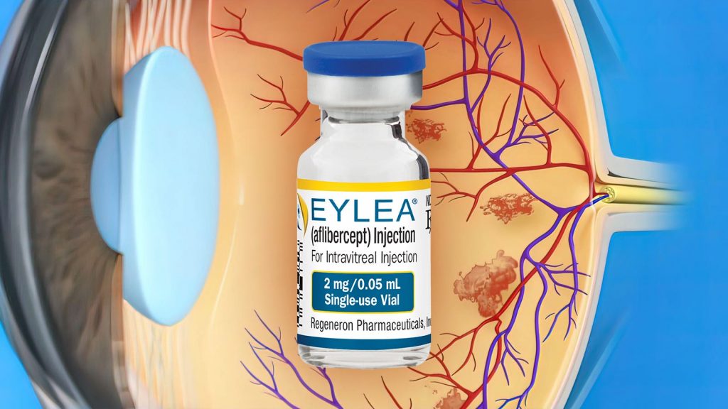 No Visual Acuity Benefit With Early Anti-VEGF for Diabetic Retinopathy