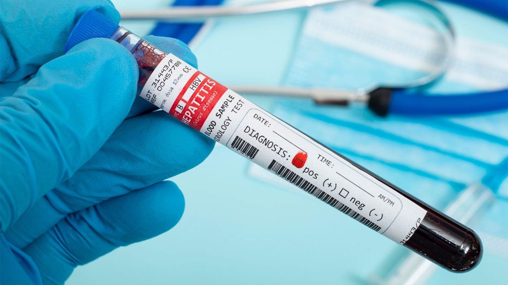 Screen All Adults for Hepatitis B, CDC Says