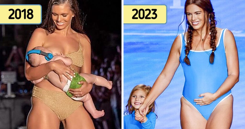 Meet the Brave Model Changing the Fashion Industry One Catwalk at a Time